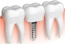 Ортопедическая стоматология